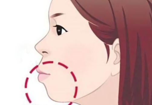 正頜正畸