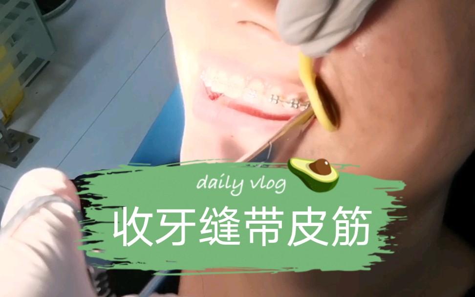 正畸拔牙收縫原理