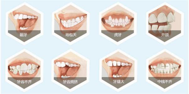 牙齒矯正禁忌癥