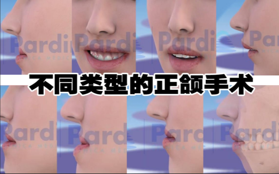 正頜正畸
