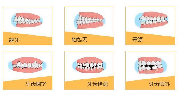 什么樣的牙齒需要正畸