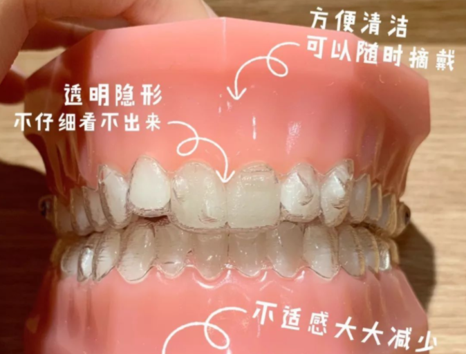 透明隱形牙套