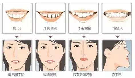 牙齒矯正器要帶多久