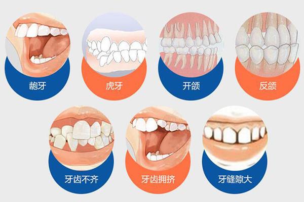 牙齒矯正調(diào)整咬合