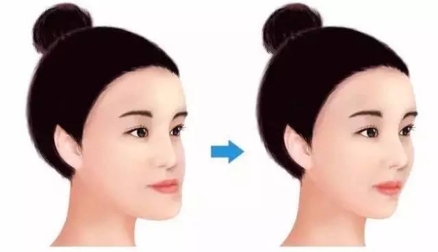 牙齒矯正最佳時(shí)期