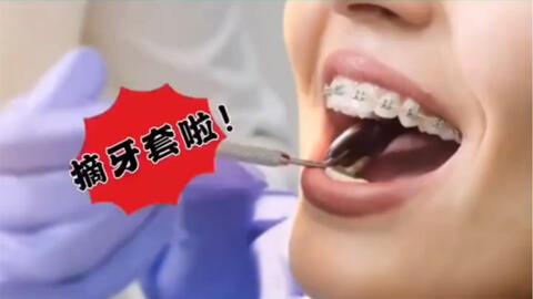 矯正牙齒的誤區(qū)