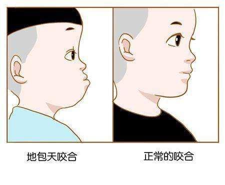 兒童矯正