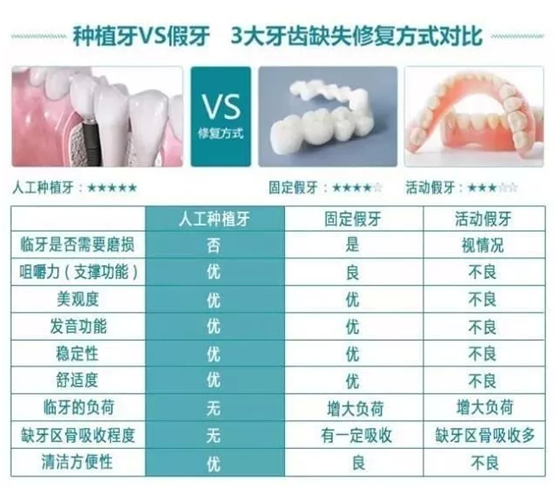 種牙還是鑲牙