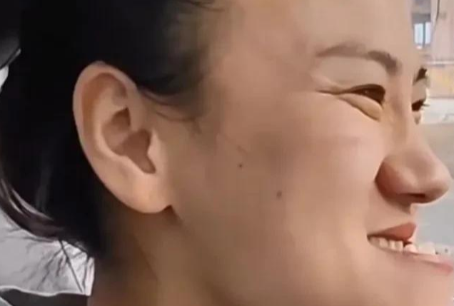 地包天兒童矯正牙齒價格
