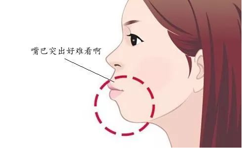 兒童牙齒早期矯正批發(fā)價格
