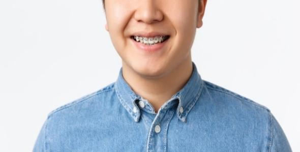 牙齒矯正