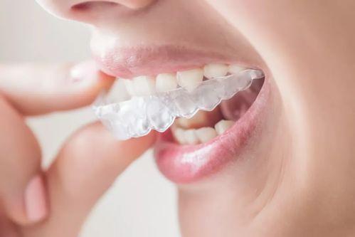 青少年牙齒矯正的口腔問題