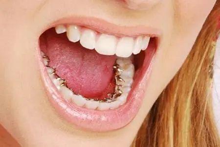 判斷矯正方案是否合理的標(biāo)準(zhǔn)