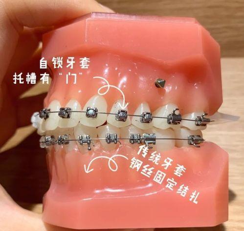 選擇正規(guī)的醫(yī)療機構和專業(yè)的醫(yī)生