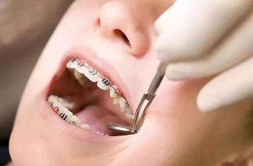 二、不適合進(jìn)行正畸正頜聯(lián)合治療的人群