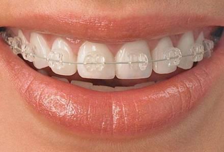 如何降低正畸正頜聯(lián)合治療的風(fēng)險(xiǎn)