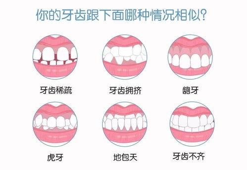 常見的錯頜畸形治療方法
