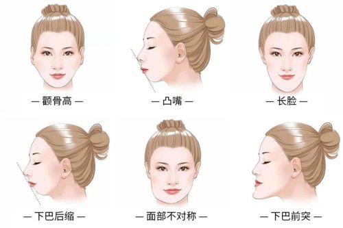 牙頜畸形的類型與成因