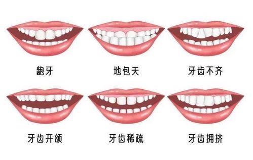 牙頜畸形的發(fā)生率