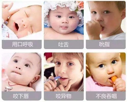 常見的兒童口腔不良習(xí)慣