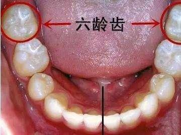 如何保護(hù)“六齡齒”