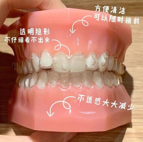 牙齒矯正后嘴凸反彈的原因