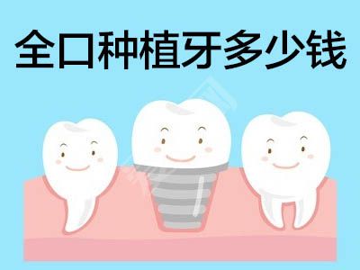 做全口種植得花多錢
