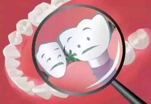 前牙種植需要滿足哪些條件 需要磨牙嗎
