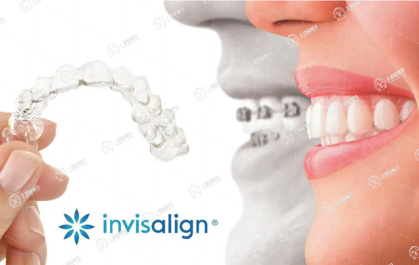 進口隱適美Invisalign