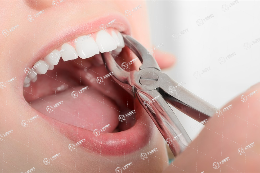 拔牙