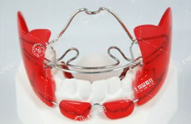 活動(dòng)矯治器