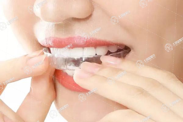 牙齒不齊的矯正方法