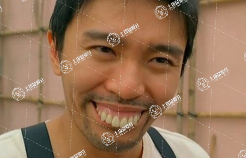 齙牙