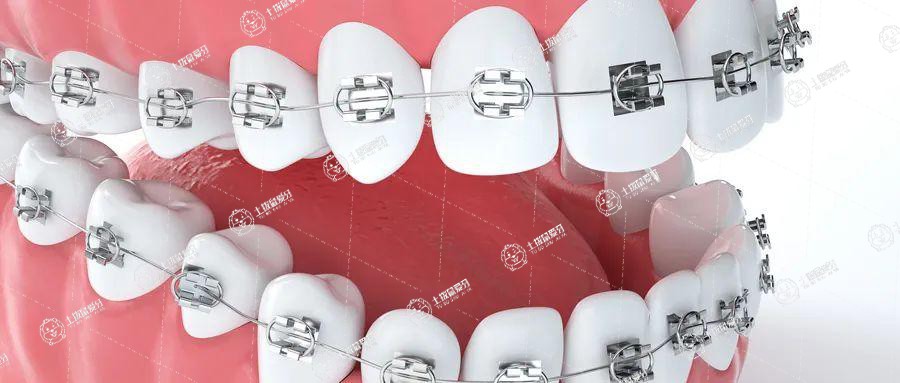 隱形矯正牙齒有效果嗎