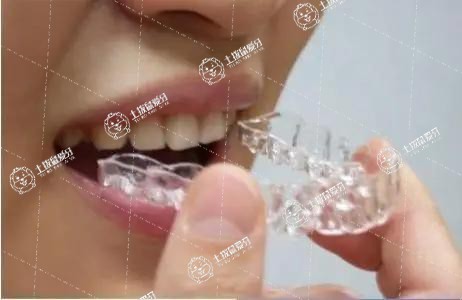 隱形矯正牙齒的過程痛嗎
