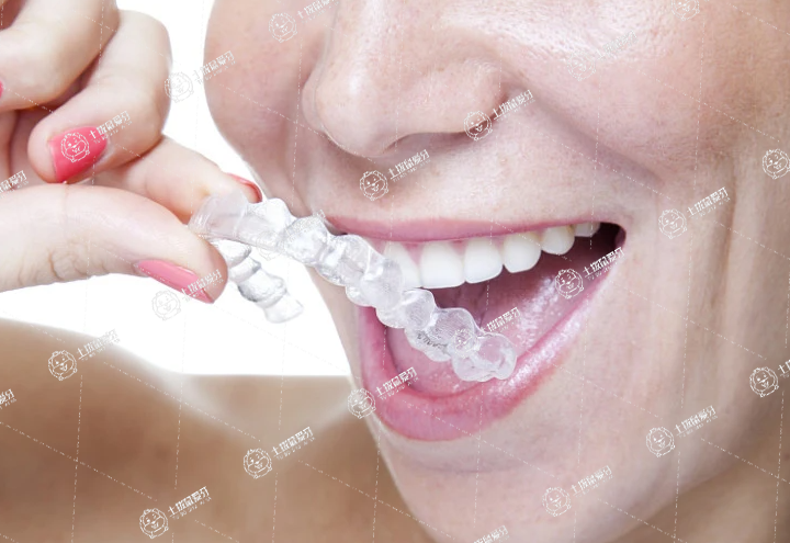 兒童牙齒矯正價格 