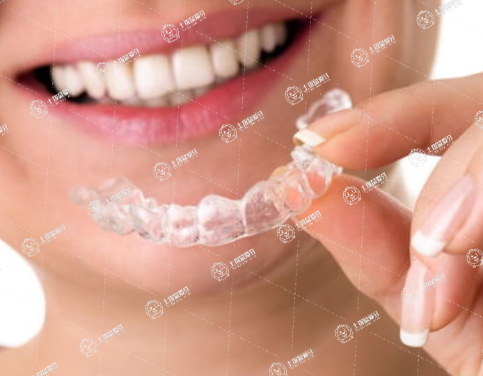 隱形牙套矯正快還是金屬牙套矯正快