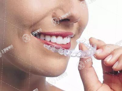 隱形牙套矯正效果好還是金屬牙套