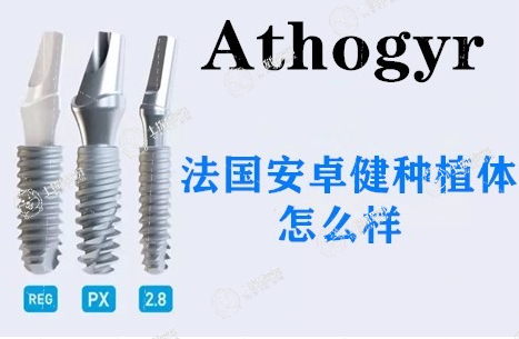 口腔醫(yī)院牙種植收費(fèi)標(biāo)準(zhǔn)