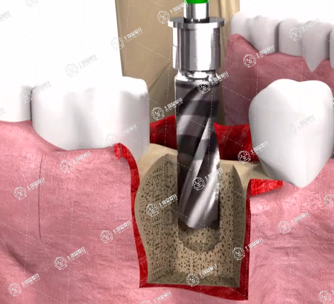 http://fznrj.cn//public/upload/hospital/2022/11-28/454d47b4fb656c061f3f9558ef6ed370.jpg