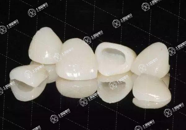 種植牙現(xiàn)在大概價(jià)格