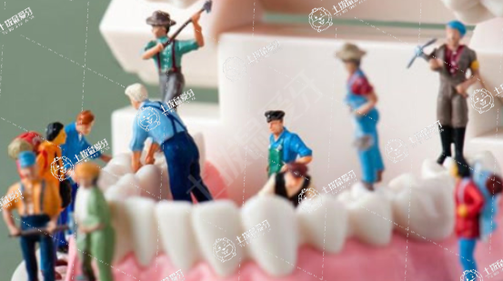 種植牙最快多長(zhǎng)時(shí)間