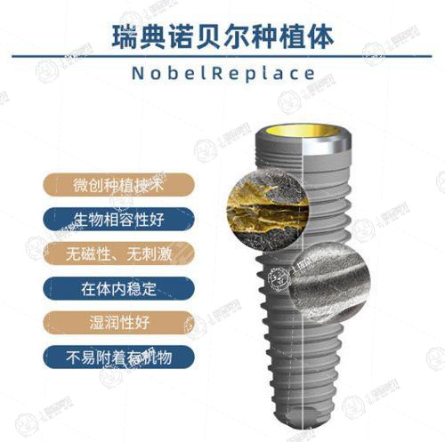 進(jìn)口種植牙哪個(gè)品牌好