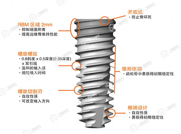 種植牙奧齒泰多少錢(qián)