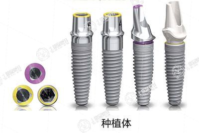一般種植牙的價(jià)格是多少