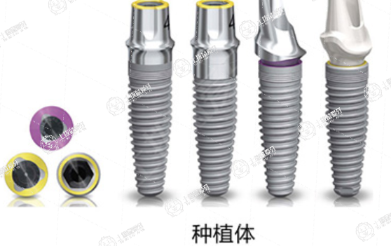 瑞士種植牙品牌有幾種類型