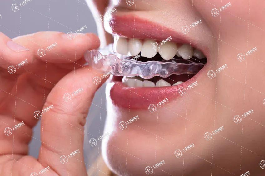 牙齒太稀疏矯正多少錢一次