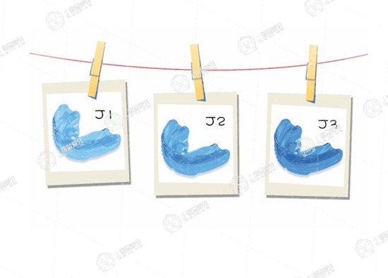 mrc牙齒矯正器一般需戴多長(zhǎng)時(shí)間