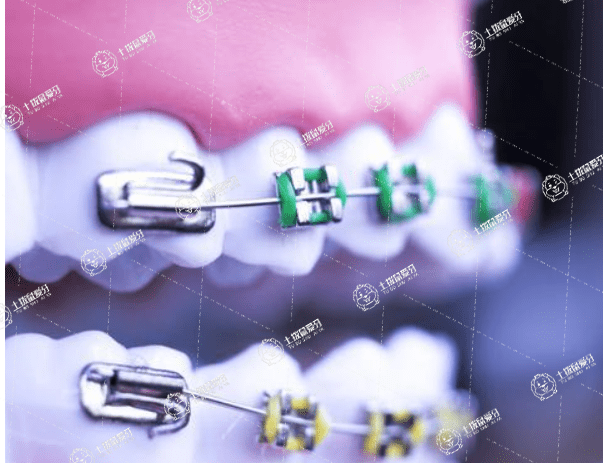 孩子牙齒地包天什么時(shí)候開始矯正