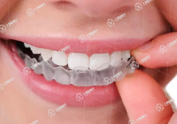 牙齒矯正后會(huì)反彈嗎